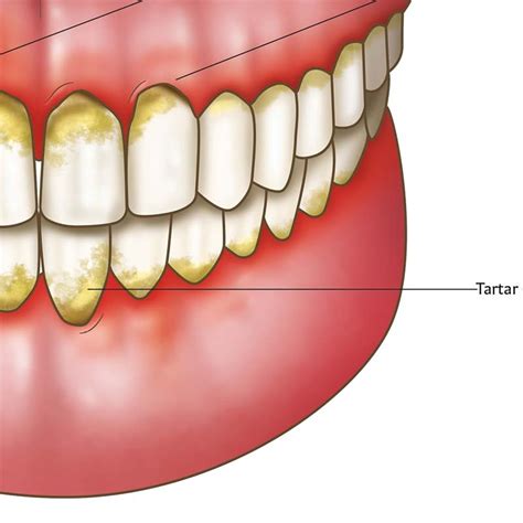 Dental Diseases And Disorders Chart Oral Health Poster