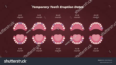 Medical Dental Diagram Illustration Orthodontist Human Stock Vector