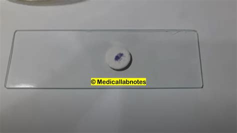 Micrococcus-Introduction, Morphology, Pathogenicity, Lab