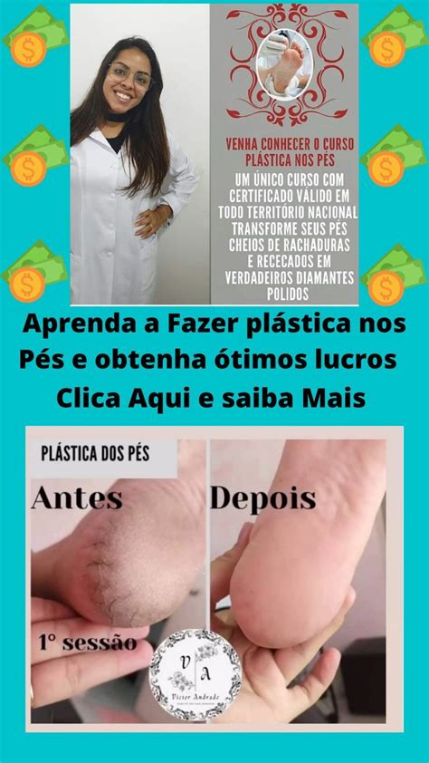 Curso PlÁstica Nos PÉs Cuidados Com Os Pés Manicure E Pedicure Pés