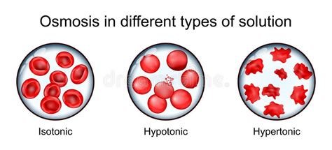 Red Blood Cell In Hypertonic Solution