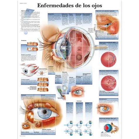 Enfermedades De Los Ojos 4006829 3b Scientific Vr3231uu