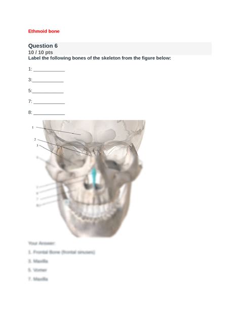 SOLUTION Biod 151 Anatomy And Physiology 1 Module Exam 4 Portage