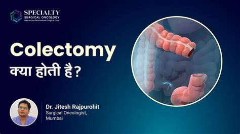 Understanding the Purpose and Procedure of Colectomy