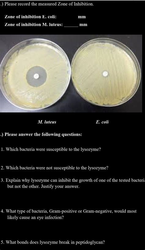 Solved Please Record The Measured Zone Of Inhibition Chegg