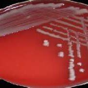 Klebsiella Pneumonia Colonies On Macconkey Agar A Blood Agar B And