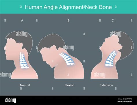 Human Angle Alignment Neck Bone Human Neck Bone In Correct Angles