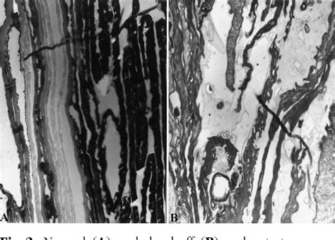 Figure 2 From Skin Diseases Associated With Malassezia Species