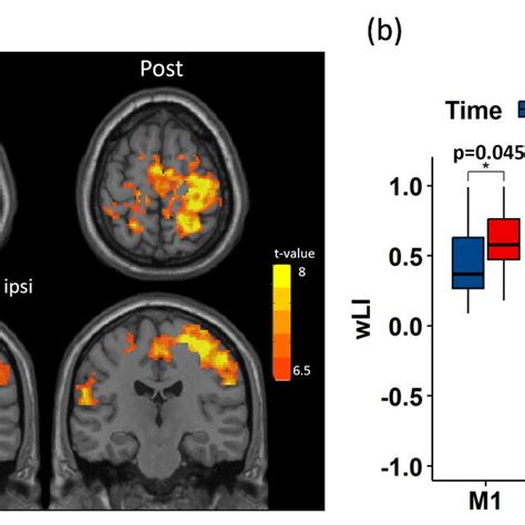 Results Of Tb Fmri Activation Analysis A Group Level Activation Map