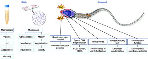 Laboratory Evaluation For Male Infertility Ros Reactive Oxygen