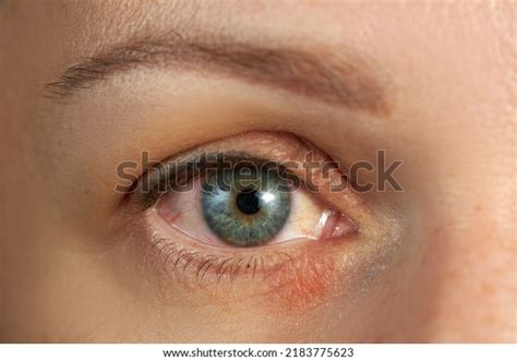 Pupil Peeling Over Royalty Free Licensable Stock Photos Shutterstock