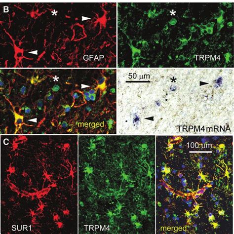 Glial Fibrillary Acidic Protein Gfap Immunoreactivity Dichotomizes