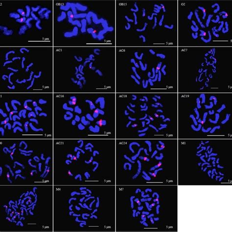 Fluorescence In Situ Hybridization FISH Analysis Using 5 S RDNA Red