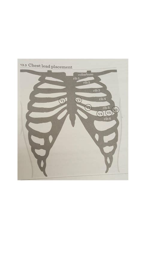 Chapter 13 Ekgcardiovascular Testing Leads Diagram Quizlet