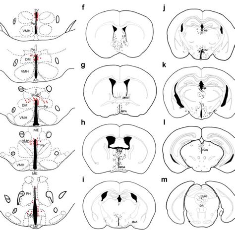 Schematic drawing of mouse brain sections showing the location of ...