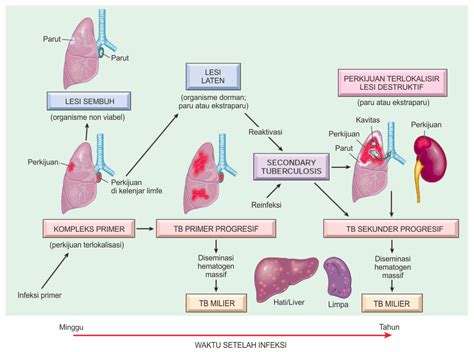 Tuberkulosis Tb Patofisiologi Diagnosis Tatalaksana Kedokteran