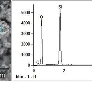 Scanning electron microscopy in the secondary electrons. Measuring ...