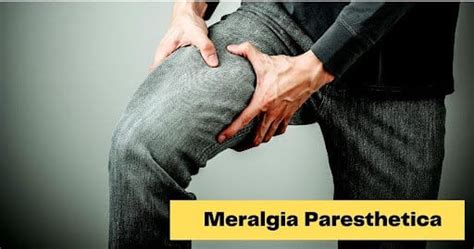 Meralgia Paresthetica Symptoms