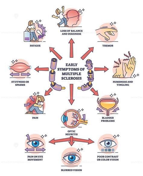 Early symptoms of multiple sclerosis and MS affected things outline ...