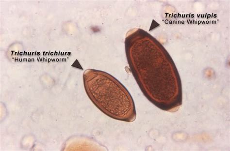 Under A High Magnification This Micrograph Depicts Both An Egg From