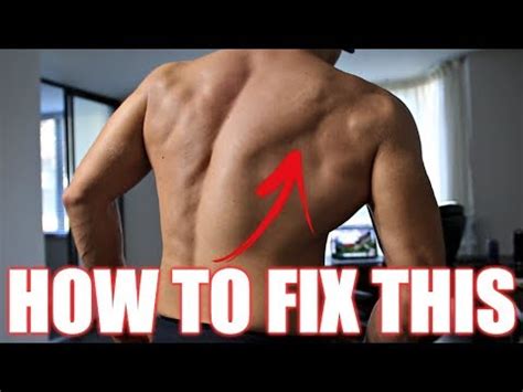 Exercises To Fix Scapular Winging Fix A Winged Scapula Youtube