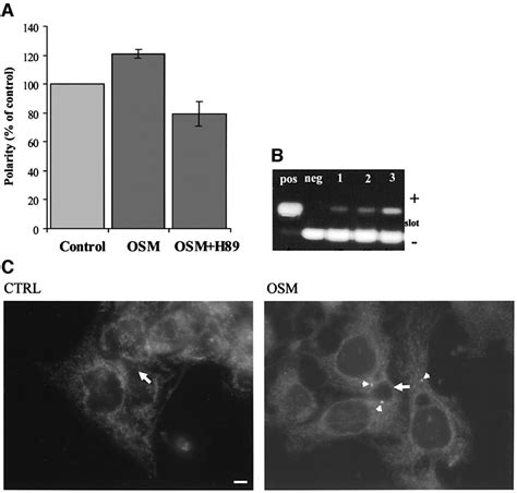 Oncostatin M Regulates Membrane Traffic And Stimulates Bile Canalicular