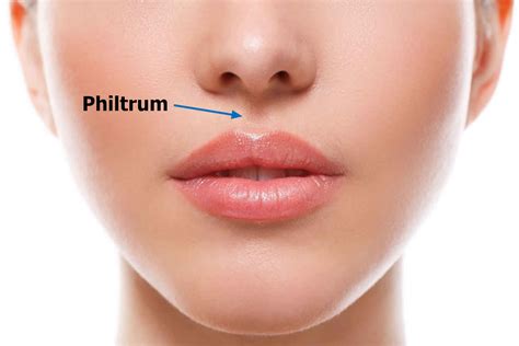 Philtrum of lip, causes of smooth philtrum, long or short philtrum