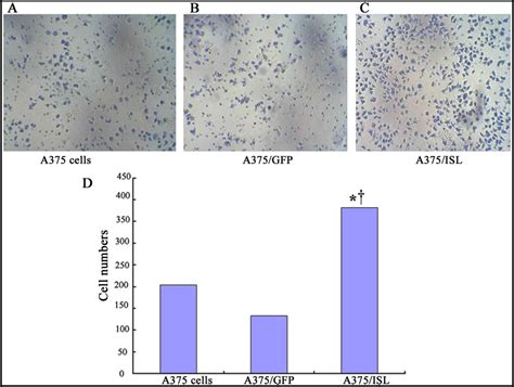 Islet 1 Promotes The Proliferation And Invasion And Inhibits The