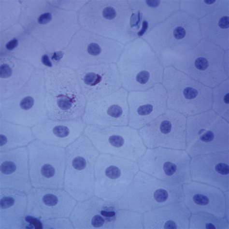 Simple Squamous Epithelium Slide Labeled