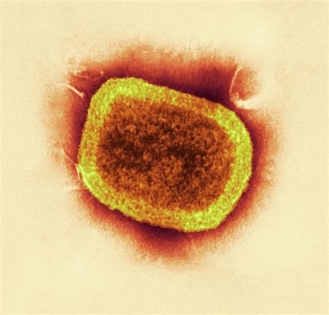 Smallpox Microscope