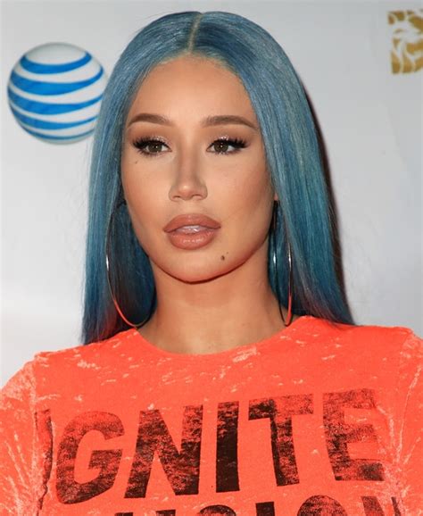 Iggy Azalea Claims Aboriginal Ethnicity Due To Eye Condition