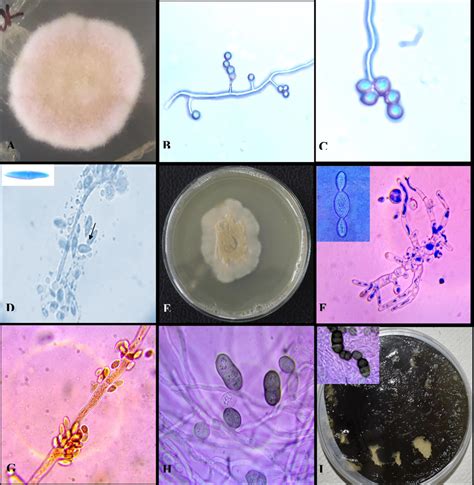 Morphology Of The Fungal Species Pure Colony Of Fusarium Proliferatum