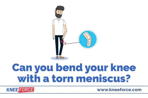 How To Wrap A Knee With A Torn Meniscus › Knee Force