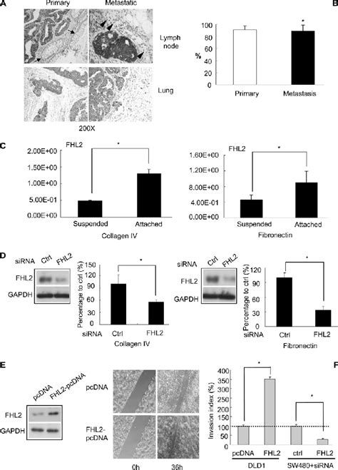 Effect Of Fhl On Metastatic Potential Of Colon Cancer Cells A The