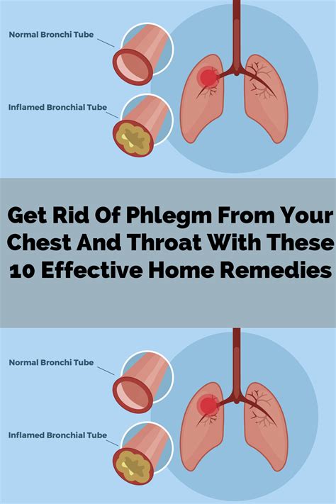 Get rid of phlegm from your chest and throat with these 10 effective ...