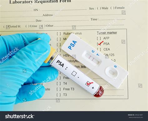 Psa Prostatespecific Antigen Positive Stock Photo 295421801 Shutterstock