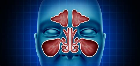 Is A Sinus Infection Contagious Sinus Lab