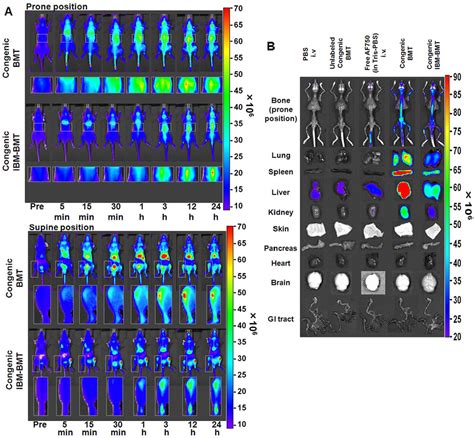 Figure 3 From Noninvasive Tracking Of Donor Cell Homing By Near