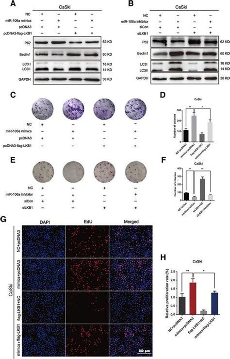 Mir 106a Regulates Cell Proliferation And Autophagy By Targeting Lkb1