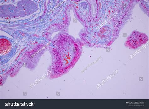 Columnar Epithelium Human Gall Bladder Under Stock Photo 2160239099