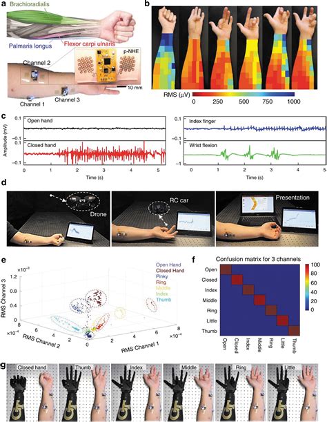 Machine Learning For Bioelectronics On Wearable And Implantable Devices Challenges And