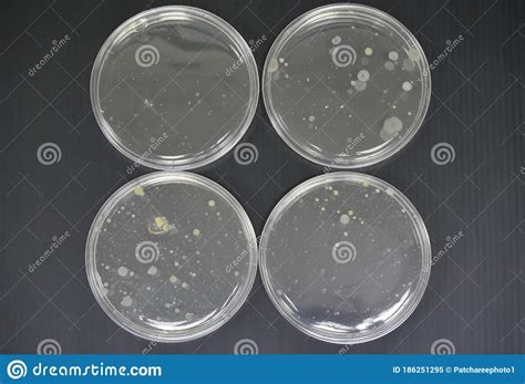 Colonies Of Bacteria In Petri Dish Stock Image Image Of Biochemistry