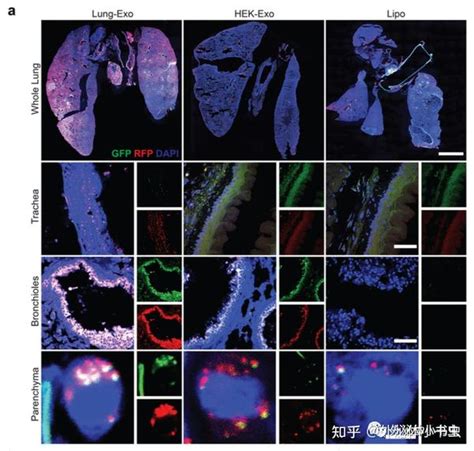 文献分享【extracell Vesicles】吸入式外泌体作为mrna载体的递送效果优于脂质体 知乎