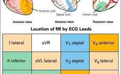 Mi Localization Litfl Ecg Anatomy Basics Otosection