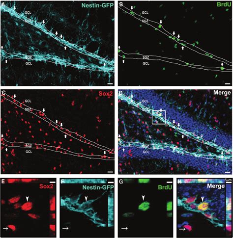 Validation Of Neural Stem Cell Nsc Proliferation Following Traumatic