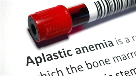 Penyakit Anemia Aplastik Penyebab Gejala Dan Pengobatan Berbagi