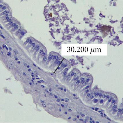 Photomicrographs Of Transverse He Stained Sections Of The Intestine Of