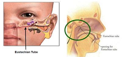 Ear Nose And Throat Connection Diagram Wiring Site Resource