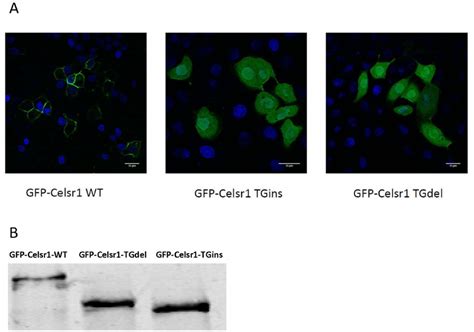 Subcellular Localization Of Gfp Celsr1 Wild Type And Tg Repeat