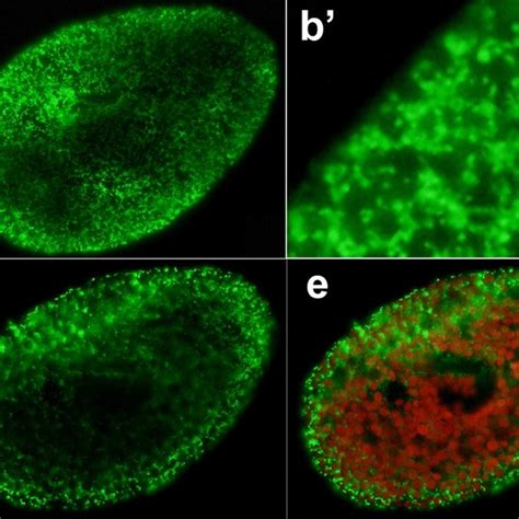 Indirect Immunofluorescence Micrographs Of Alga Free P Bursaria Strain